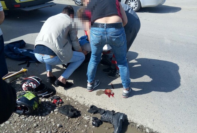 Мотоциклист и его пассажирка получили тяжелые травмы в Краснодаре