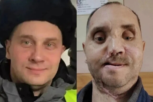 «После аварии я стал уродом»: искалеченный в ДТП житель Барнаула борется за справедливость 