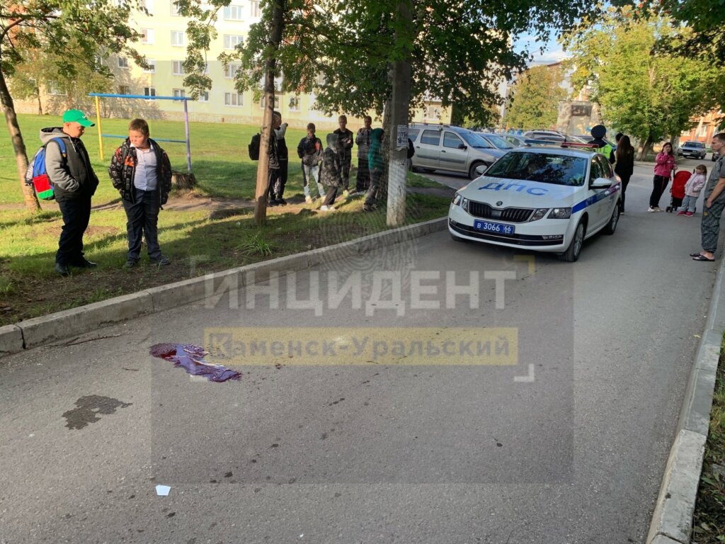 В Каменске-Уральском 16-летний подросток на самокате сбил 67-летнюю женщину