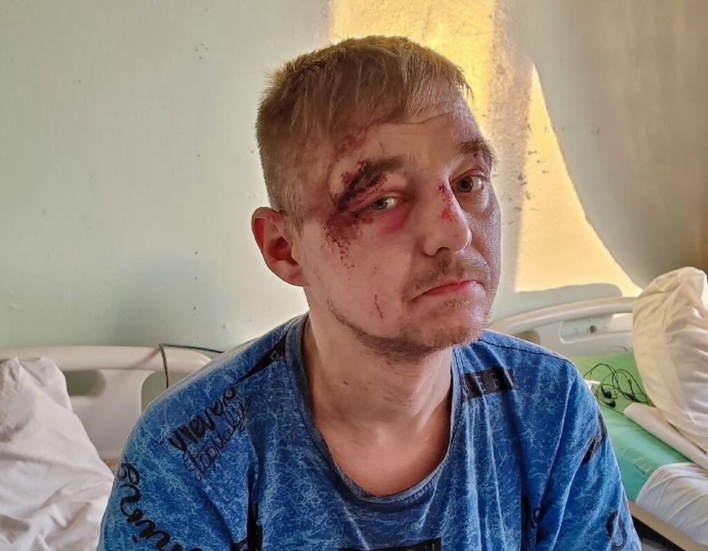 Во Владимирской области «Газель» сбила инвалида-колясочника