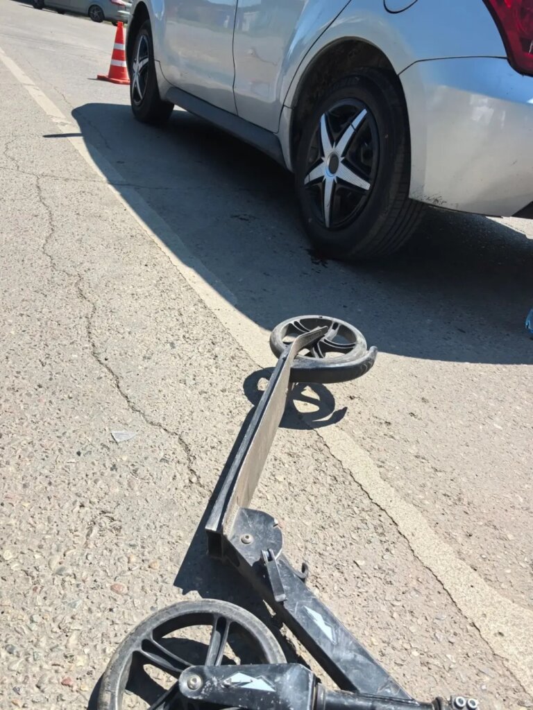 «Упал и ударился головой о колесо»: в Красноярском крае Lada Granta сбила ребенка на самокате